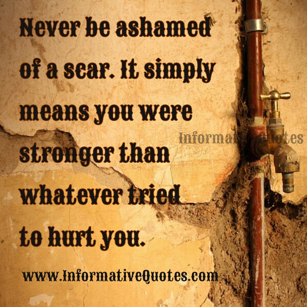 Never be ashamed of your Scar Informative Quotes