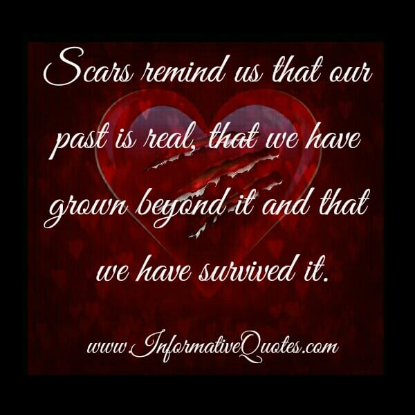 What scars remind us about?